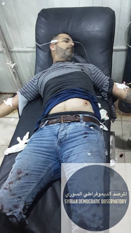 استشهاد طفل و إصابة مدنيين بينهم أطفال في القصف المدفعي العشوائي الذي طال المناطق السكنية في حيي الشيخ مقصود والأشرفية من قبل الفصائل التابعة لنظام الجولاني ، أسماء المصابين والشهيد كالتالي:
