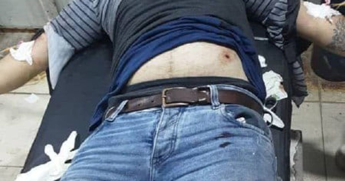 استشهاد طفل و إصابة مدنيين بينهم أطفال في القصف المدفعي العشوائي الذي طال المناطق السكنية في حيي الشيخ مقصود والأشرفية من قبل الفصائل التابعة لنظام الجولاني ، أسماء المصابين والشهيد كالتالي: