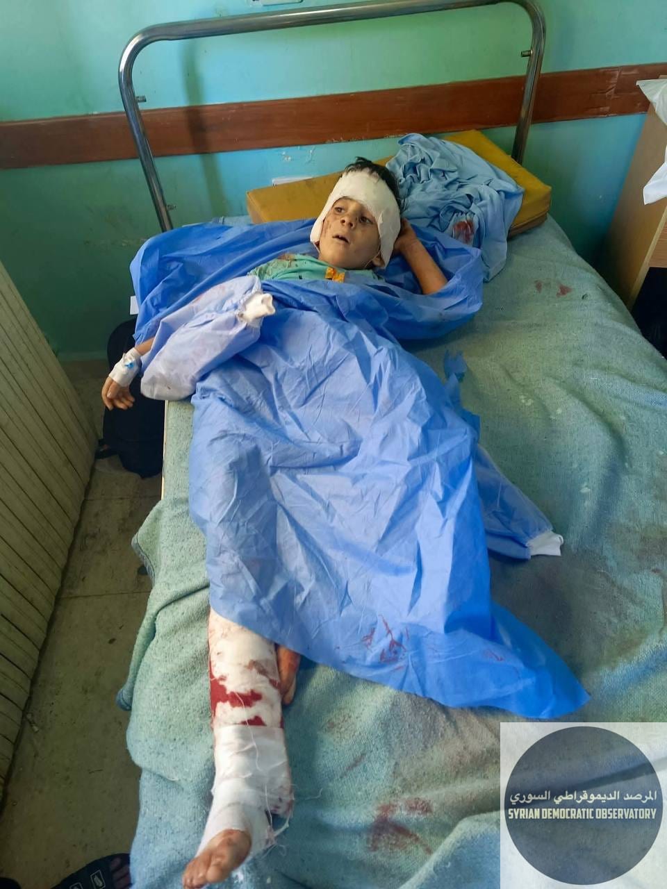 صور كاملة للأطفال المصابين نتيجة قصف نظام الجولاني على بيوت المدنيين في السويداء