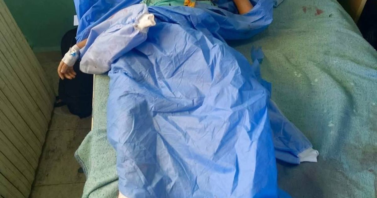صور كاملة للأطفال المصابين نتيجة قصف نظام الجولاني على بيوت المدنيين في السويداء