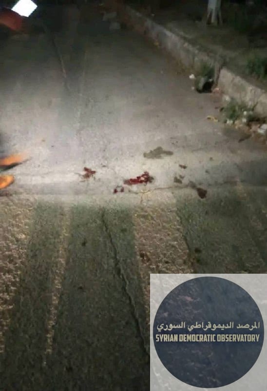 استشهاد مواطن علوي متأثراً بجراحه