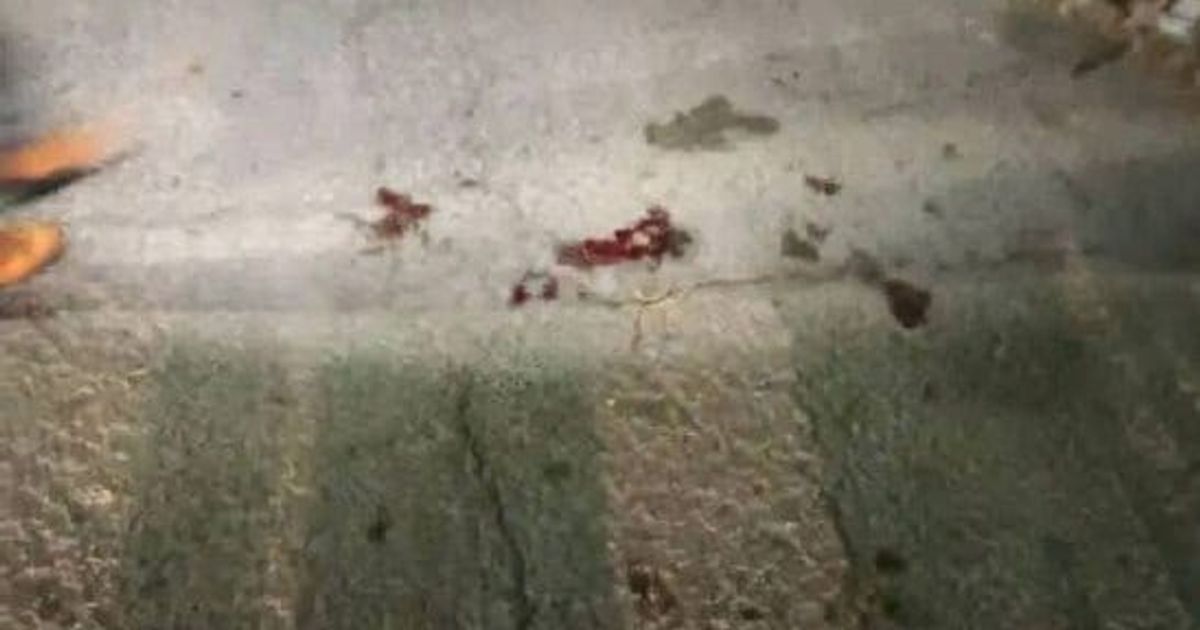 استشهاد مواطن علوي متأثراً بجراحه