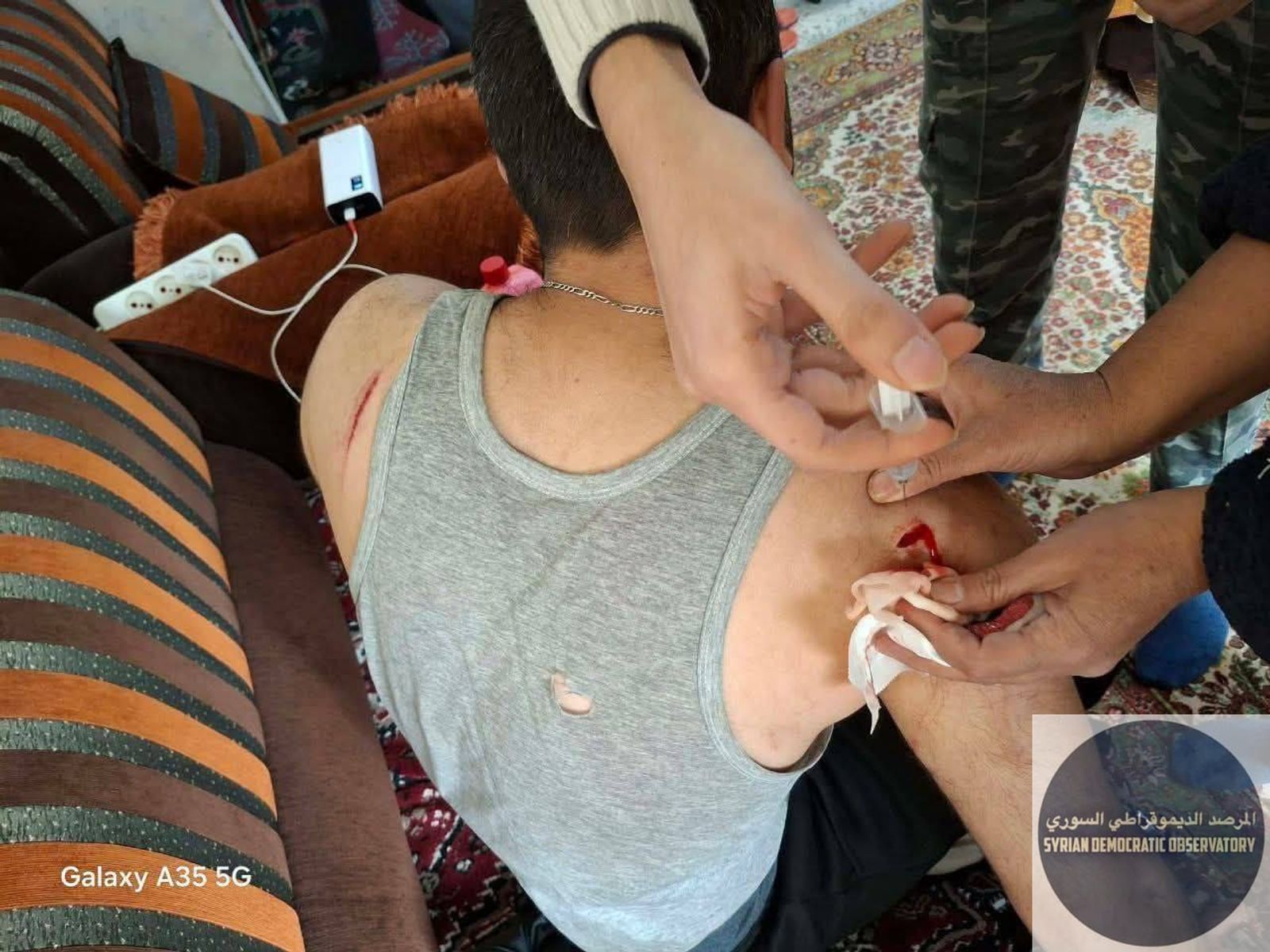 جبلة صور تظهر إصابات التي تعرض لها الأب وابنه من الفيديو السابق بعد قيام الابن بحماية أبيه باحتضانه حماية له من هجمات موالي الجولاني في