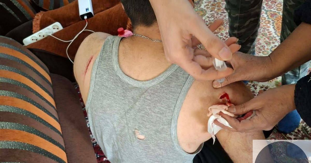 جبلة صور تظهر إصابات التي تعرض لها الأب وابنه من الفيديو السابق بعد قيام الابن بحماية أبيه باحتضانه حماية له من هجمات موالي الجولاني في
