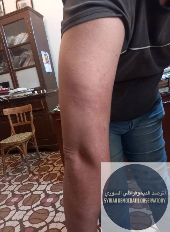 محاولة خطف و تهديد بالقتل وتعذيب وسرقة رجل مسيحي في حمص
