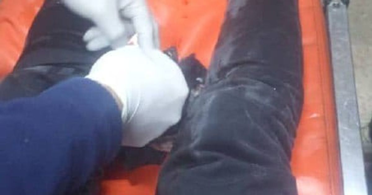 المدني احمد محمد محمد، 24 سنة تعرض للإصابة نتيجة قصف إ فصائل الجولاني الإرهابي على حيي الشيخ مقصود والأشرفية.