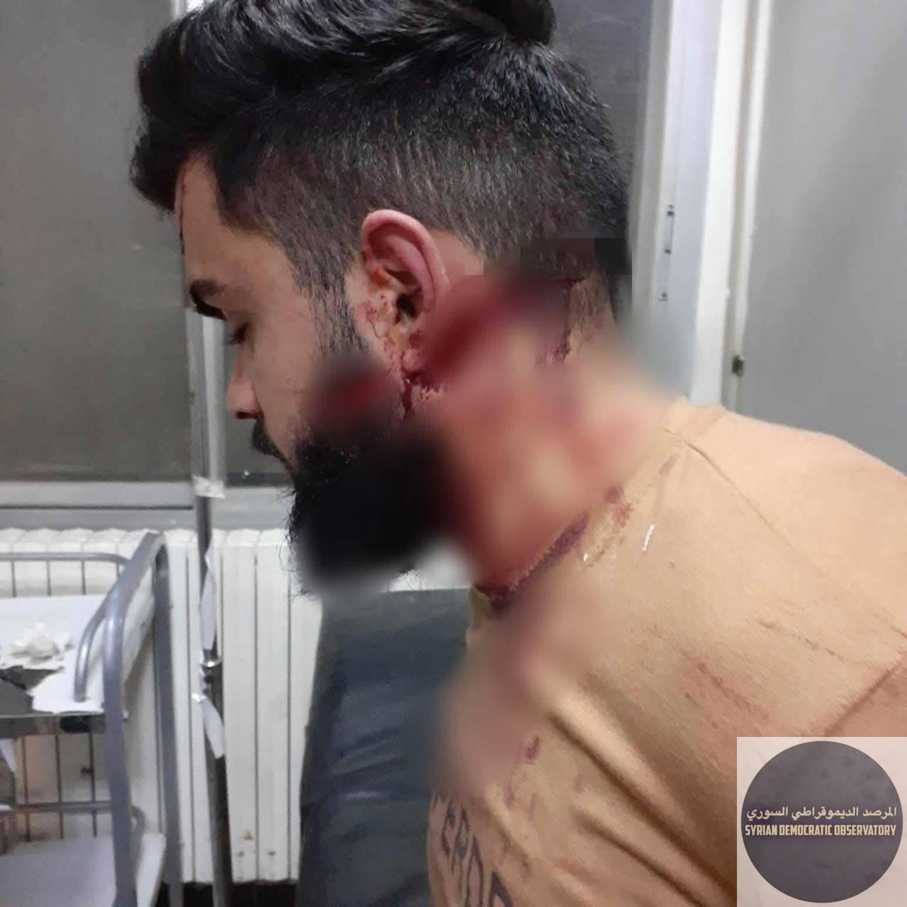 Attempted Murder of Young Man Mahmoud Deeb Iskandar, 21 years old, in His Home in , Last Night