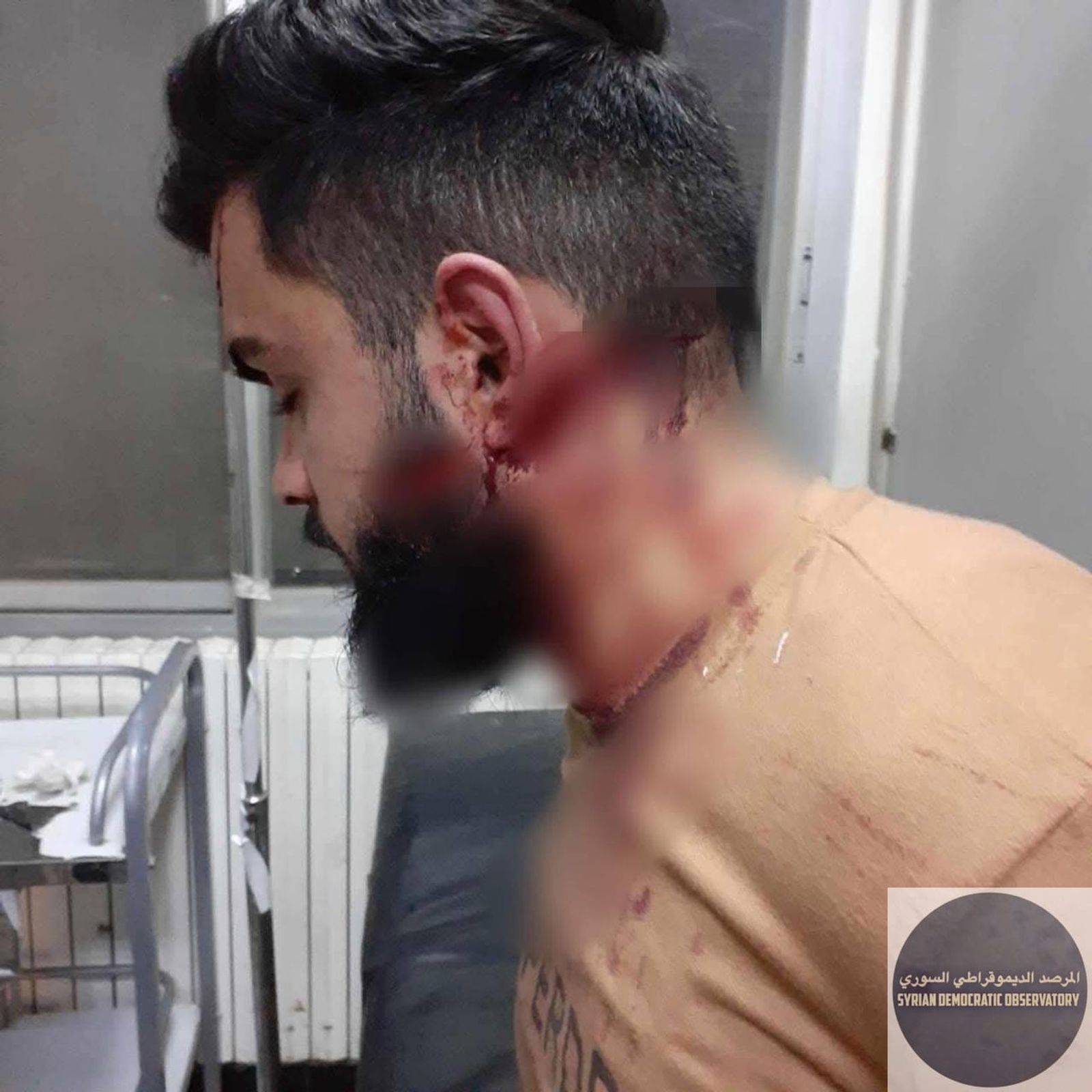 Attempted Murder of Young Man Mahmoud Deeb Iskandar, 21 years old, in His Home in , Last Night