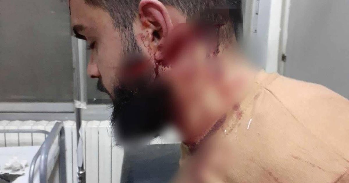Attempted Murder of Young Man Mahmoud Deeb Iskandar, 21 years old, in His Home in , Last Night