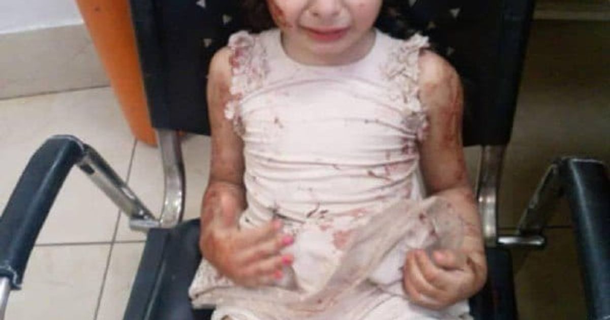 دمشق: طفلة من المصابين في التفجير الانتحاري الذي استهدف كنيسة مار الياس بدمشق، موجودة لوحدها بمشفى الفرنسي بالقصاع، تقول أنها من عائلة بشارة، نرجو لمن يتعرف عليها أن يخبر أهلها أو أقربائها