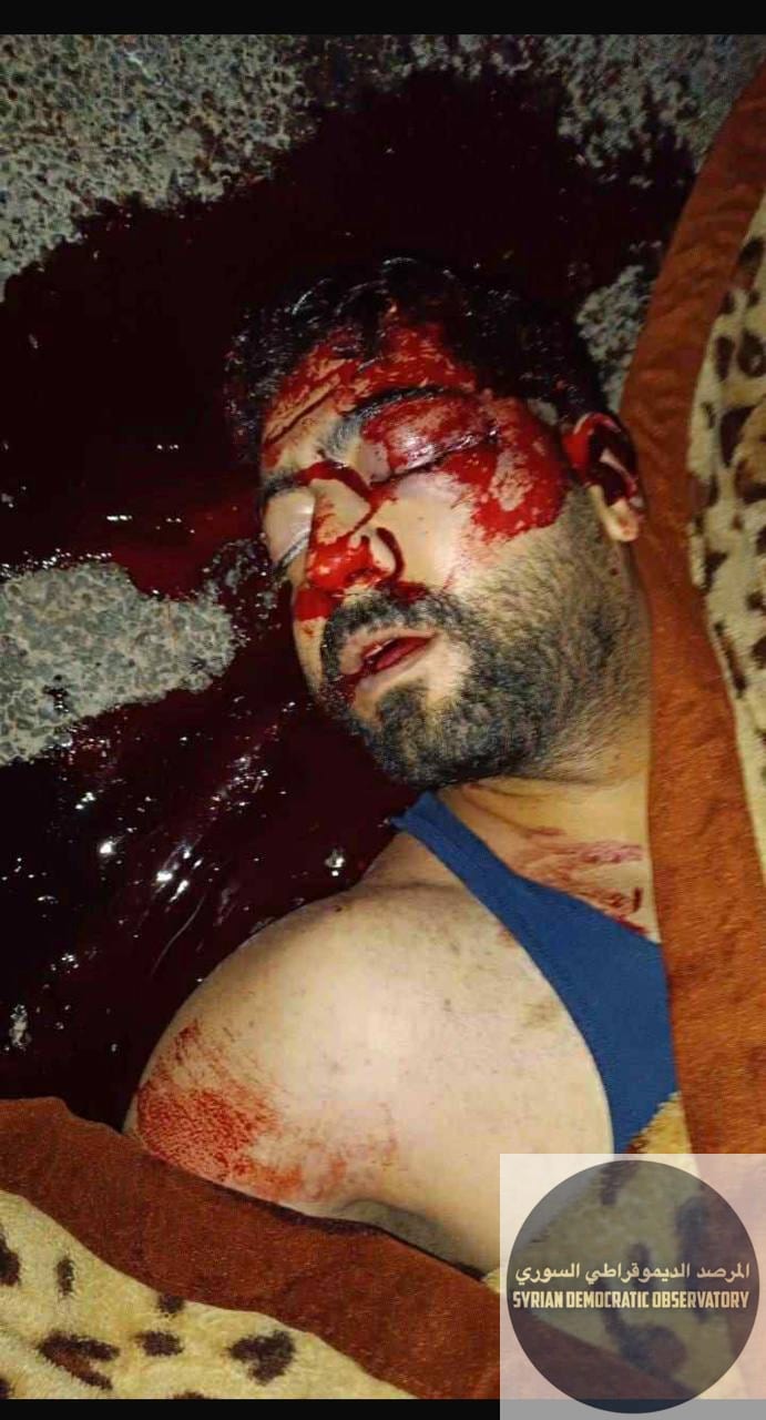 صورة لجثمان الشاب يزن لؤي العلي، 25 عاماً