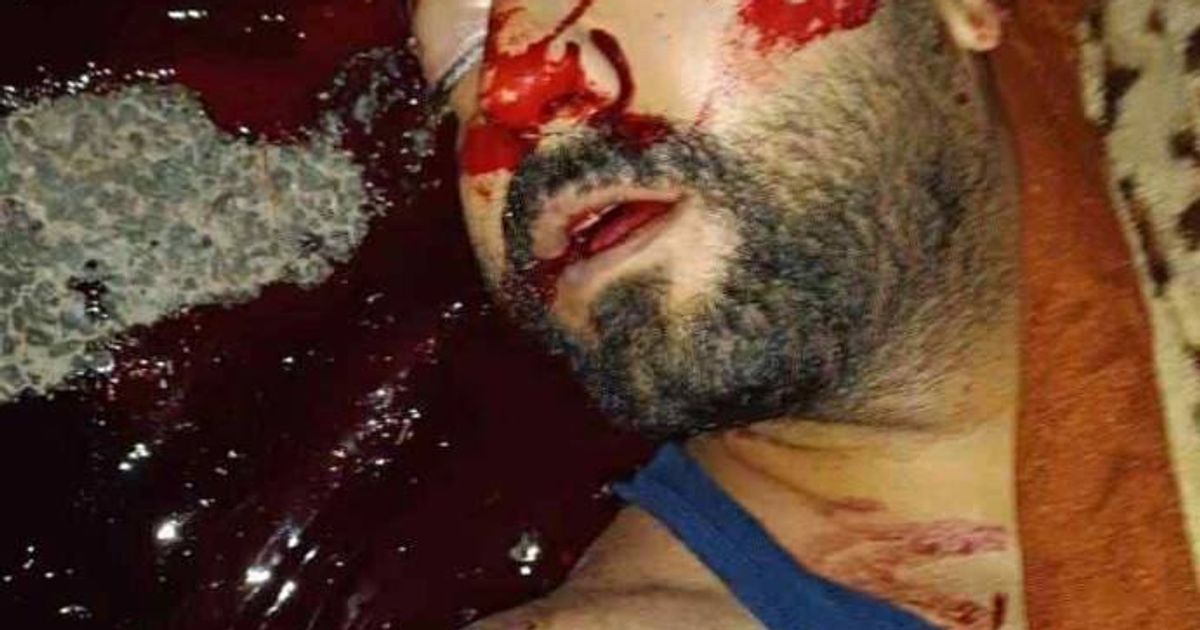 صورة لجثمان الشاب يزن لؤي العلي، 25 عاماً