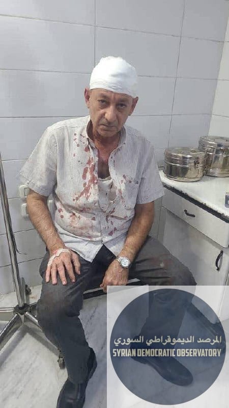طبيب علوي ينجو من محاولة اغتيال في دمشق