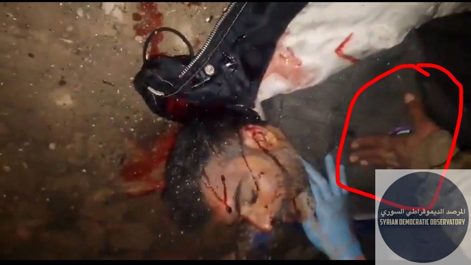 يبدو أن للشاب عزوز والذي تعرض للتعذيب يوم أمس قصة أكبر، فهم كانوا يقولون له"انت تنشر عالفيس" ،"على شو تهدد الشباب"،"تهدد مننا حدا على الفيسبوك" .