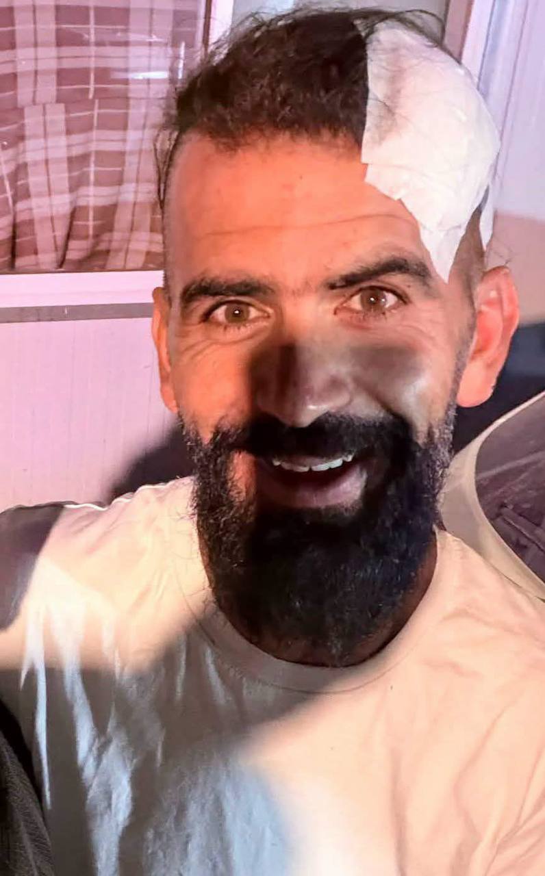 ‏شاب درزي موالي لنظام الجولاني يتعرض للضرب، وبيان لمديرية الإعلام يضرب المنطق بعرض الحائط