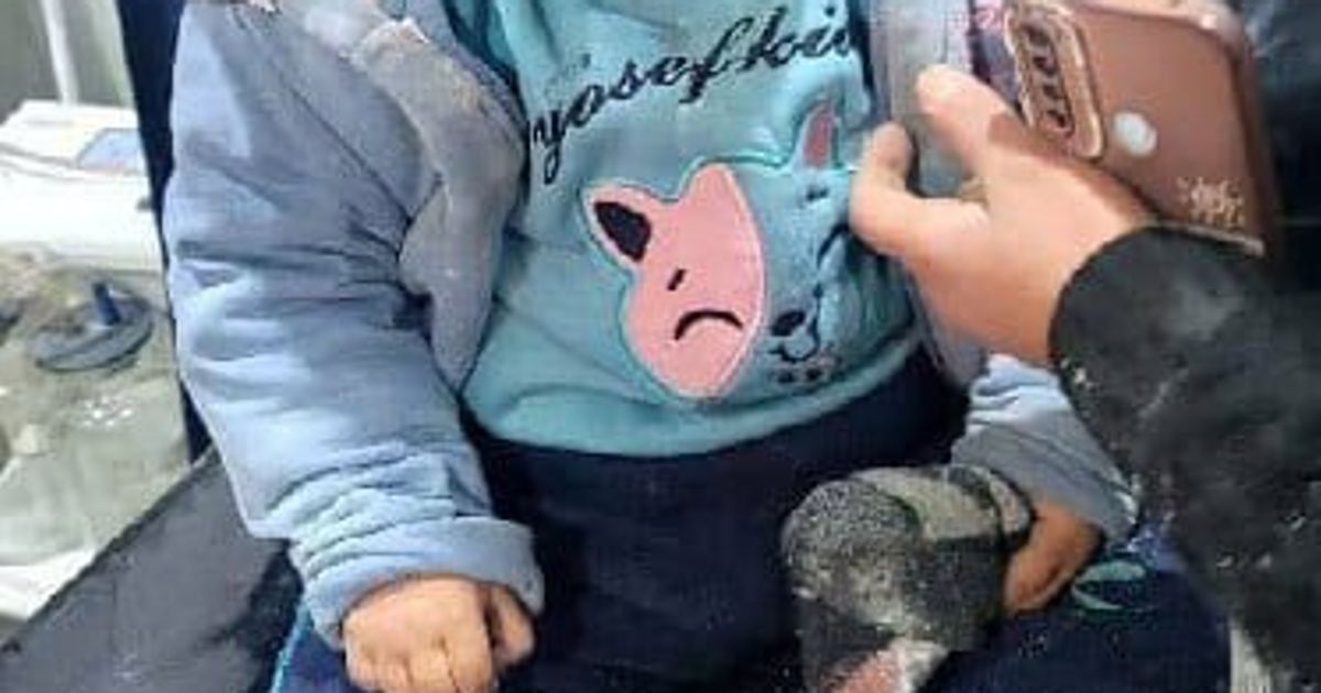 سقوط عدد من الشهداء وإصابة مدنيين بينهم أطفال بسبب القصف العشوائي من قوات نظام الجولاني الإرهابية على أحياء الشيخ مقصود والأشرفية ، إصابة الطفلتان الكرديات إيفان عبدو و شام دلو