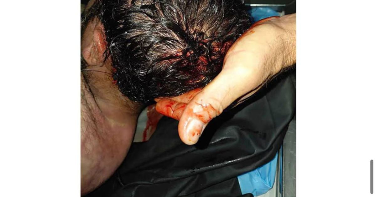 روايات مرعبة عن تعذيب حتى الموت في سجون الجولاني، أحد المعتقلين تم ذبحه من عنقه