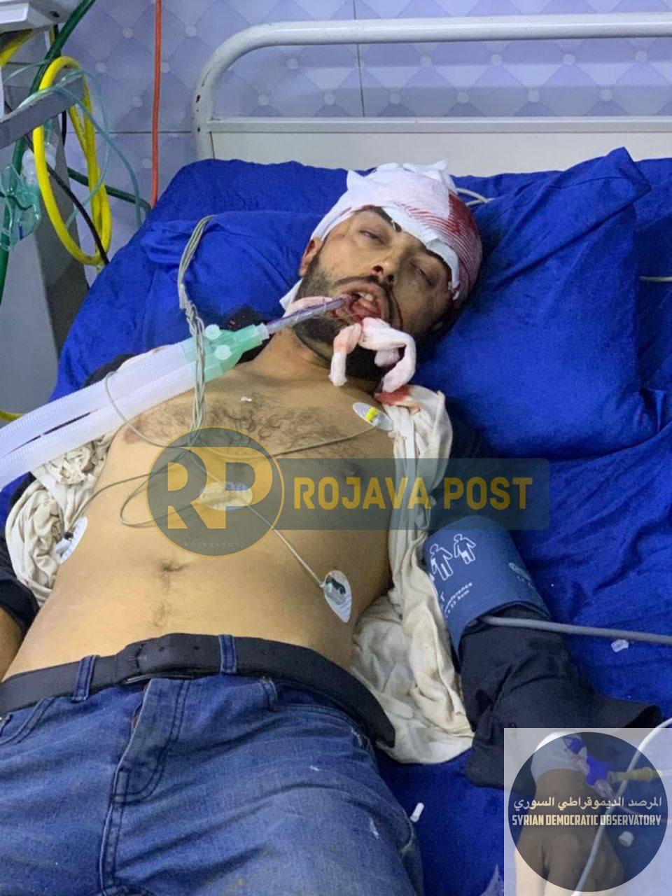 حلب: إصابة مدنيين نتيجة قصف مدفعي عشوائي لميلشيات حكومة الجولاني الإرهابية على حيي الشيخ مقصود والأشرفية.