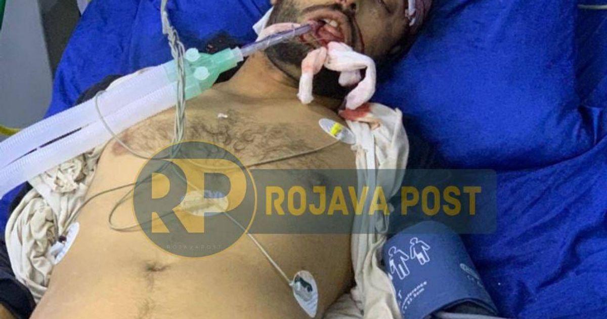 حلب: إصابة مدنيين نتيجة قصف مدفعي عشوائي لميلشيات حكومة الجولاني الإرهابية على حيي الشيخ مقصود والأشرفية.