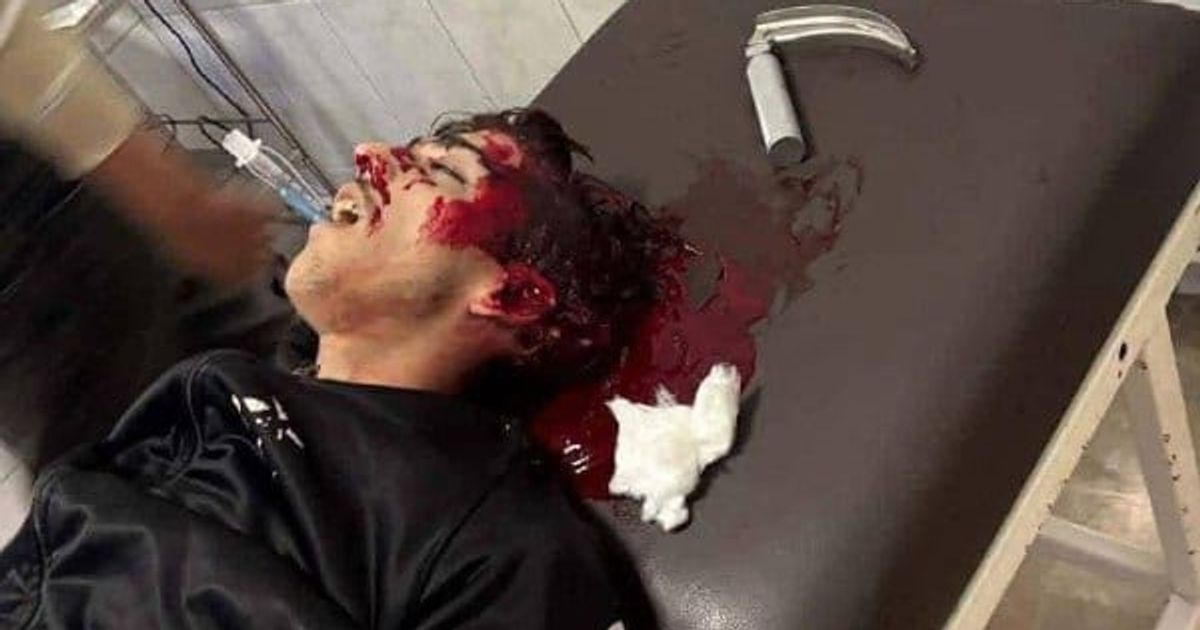 الساحل السوري: مجموعة من الفيديوهات و الصور لاعتداءات بالرصاص الحي و مصابين وشهداء.