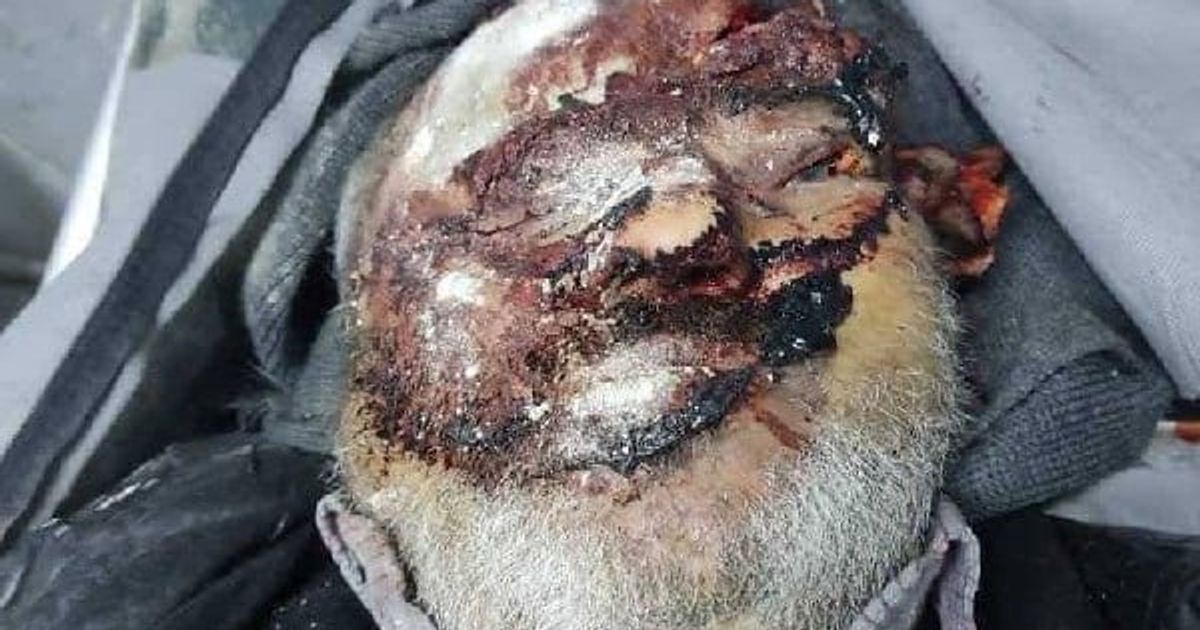 Killed After Abduction and Torture: