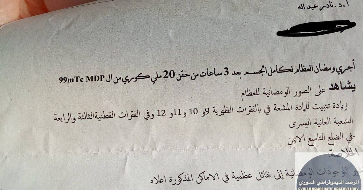 الحالة رقم 2