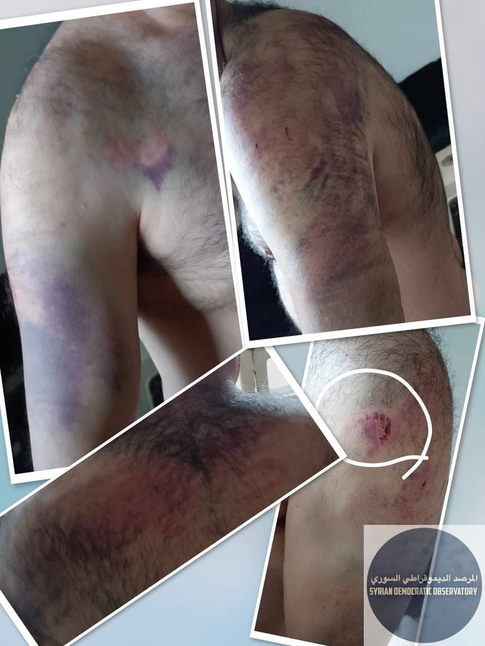 Homs Countryside | Civilian Man Detained and Brutally Beaten by Armed Militants