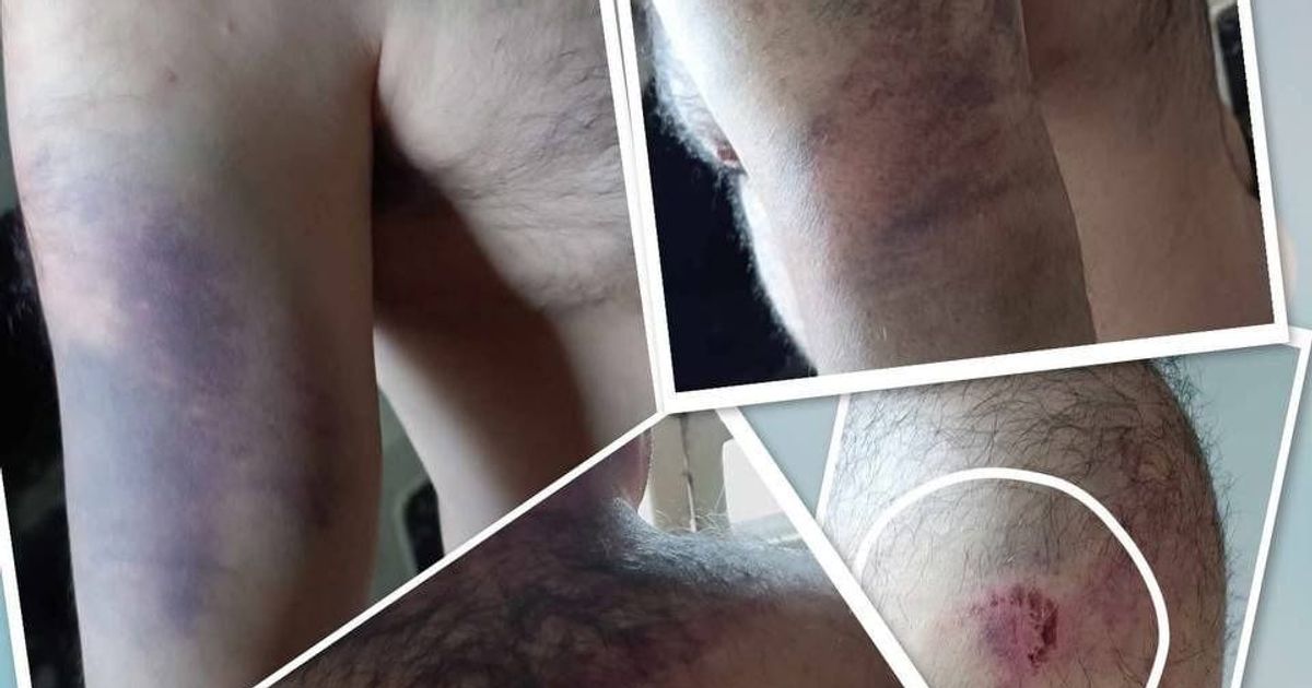 Homs Countryside | Civilian Man Detained and Brutally Beaten by Armed Militants