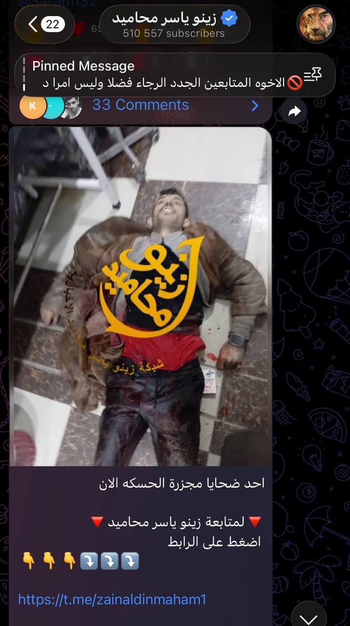 معلش نحكي كلمتين بالعامية!