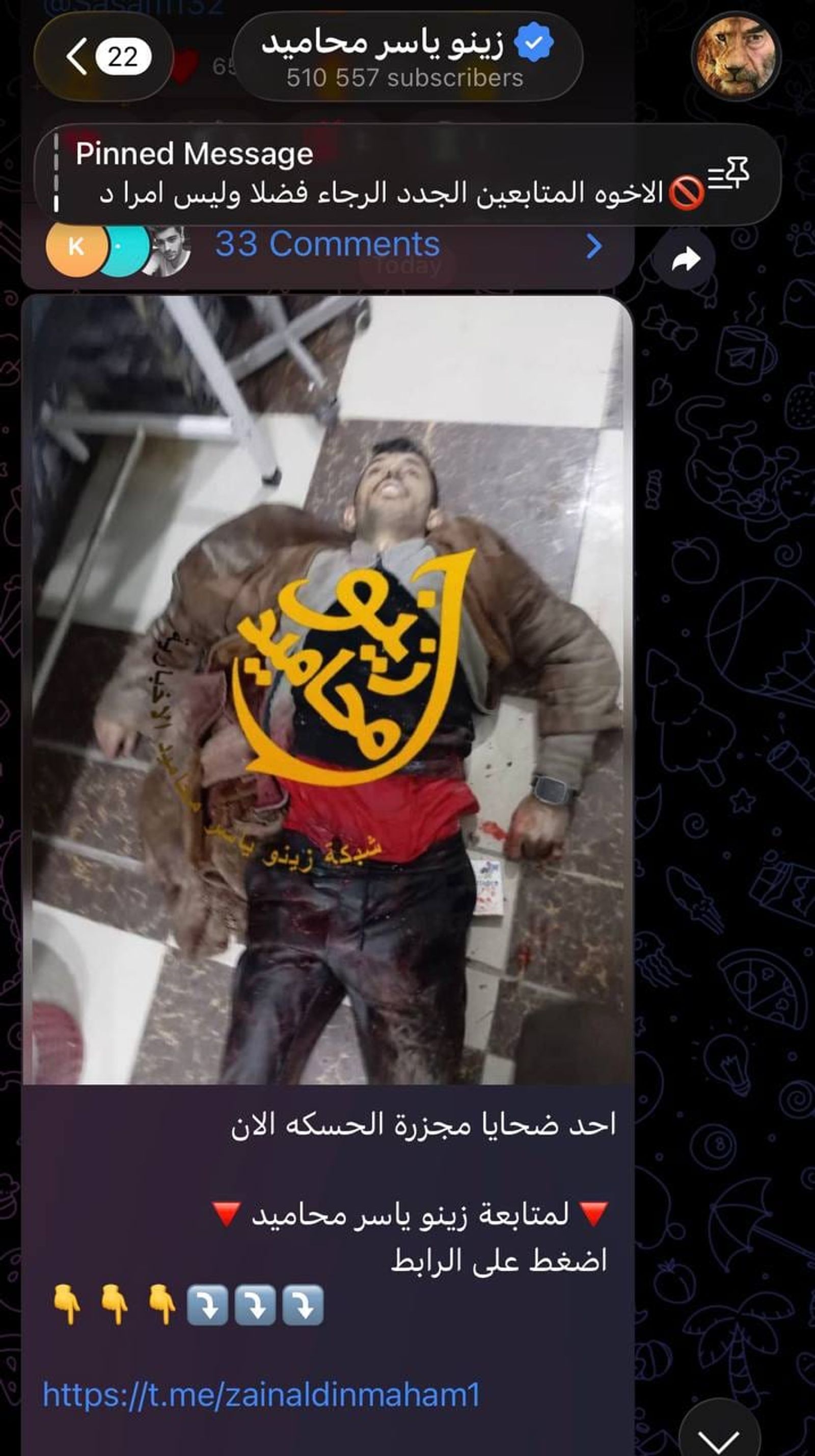 معلش نحكي كلمتين بالعامية!