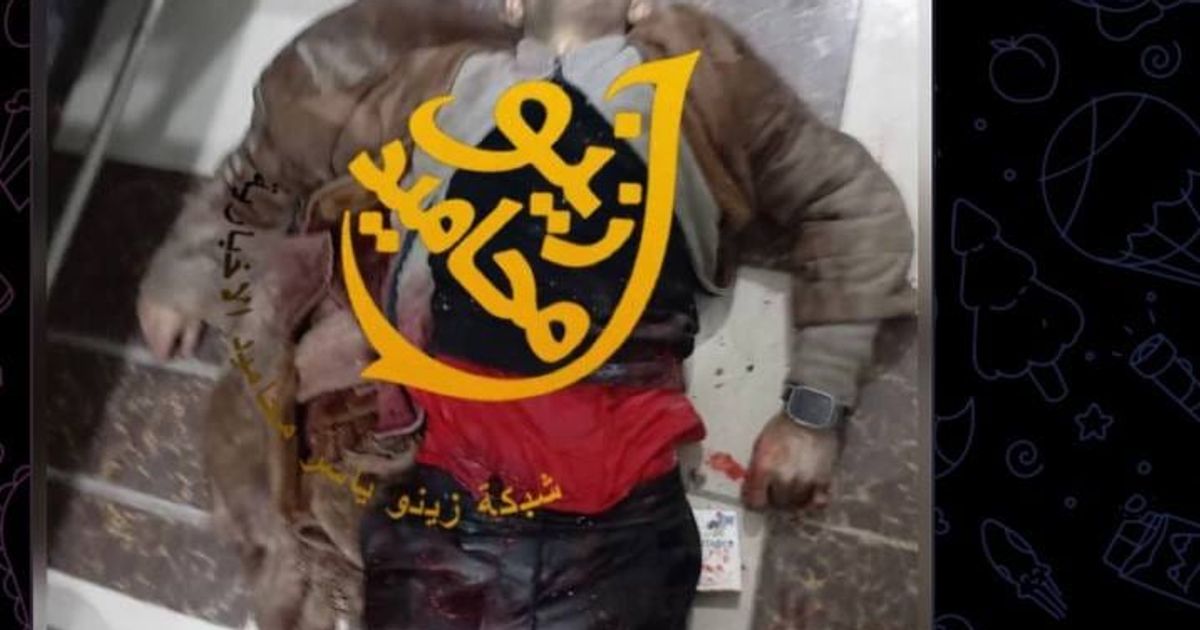معلش نحكي كلمتين بالعامية!