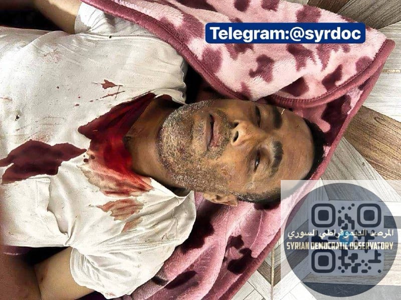 استشهاد 9 مدنيين أكراد معظمهم من الأطفال في كوباني شمال بقصف صاروخي تركي.