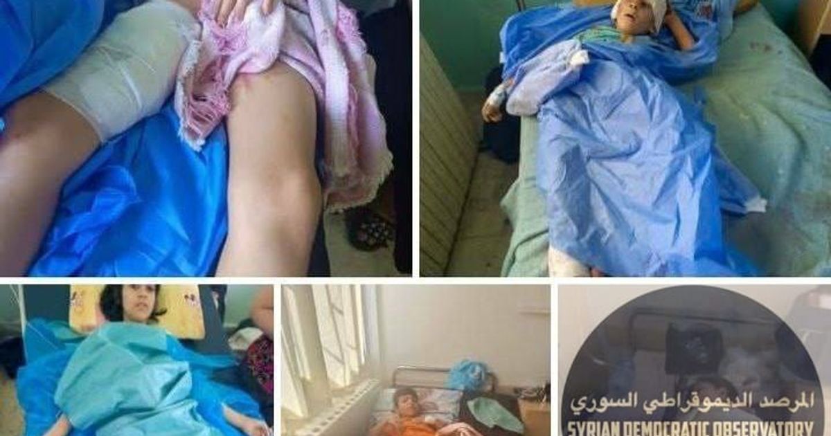 أطفال مصابين من السويداء آثر القصف العشوائي التي تنفذه حكومة الجولاني الإرهابية
